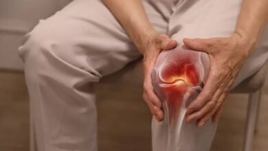 علاج طقطقة الركبة